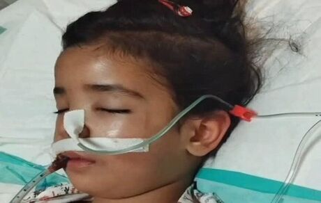 کودک ۴ ساله شکنجه شده توسط نامادری جان باخت