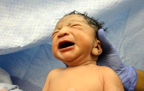 نیاز ۴ میلیون زوج نابارور به خدمات درمان ناباروری در کشور