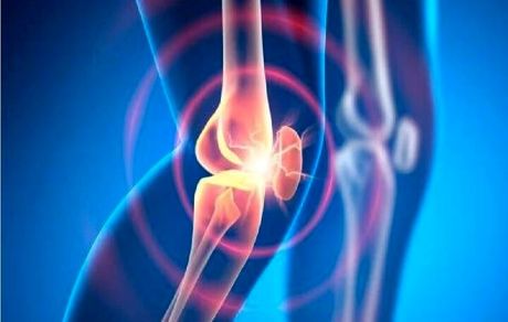 درمان آرتروز با یک داروی آزمایشی