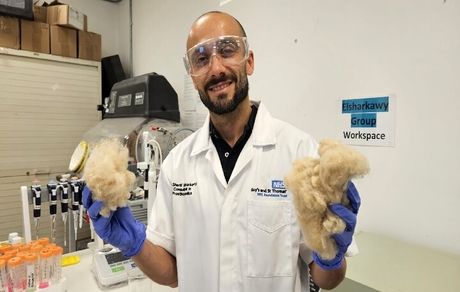 کشف دانشمندان: پشم ماده‌ای برای ترمیم استخوان‌های آسیب‌دیده