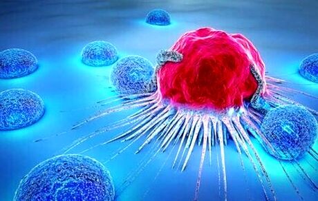 احتمال قرارگرفتن واکسن عفونت HPV در برنامه واکسیناسیون ملی
