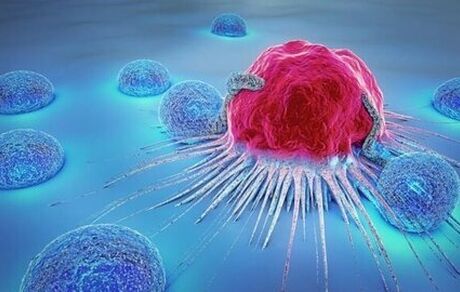 احتمال قرارگرفتن واکسن عفونت HPV در برنامه واکسیناسیون ملی