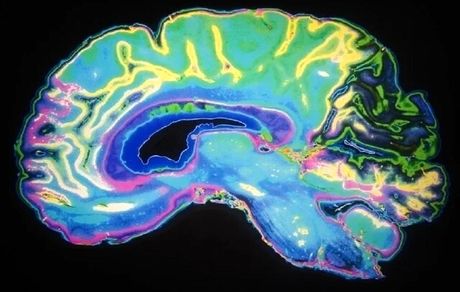 کشف مسیر انتقال ریزذرات مضر از ریه‌ها به مغز