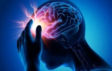 روزانه، ۵۰۰ ایرانی دچار سکته مغزی می‌شوند!