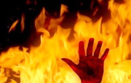 مردمعتاد همسرش‌ رابه‌ آتش‌ کشید