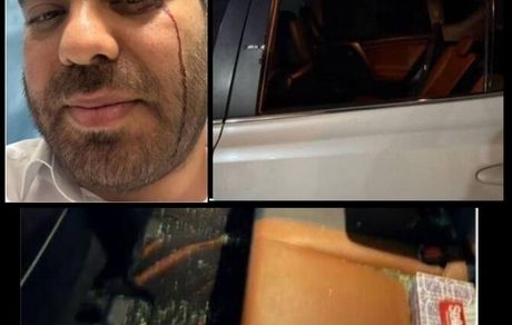 تیراندازی فردی ناشناس به مدیر مجتمع پتروشیمی امیرکبیر