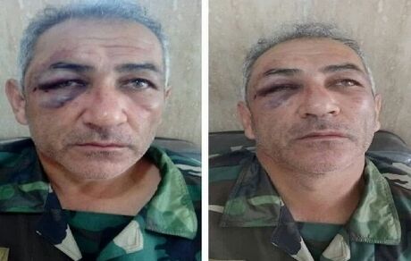 جنگل‌بان آستارایی مورد ضرب و شتم قرار گرفت