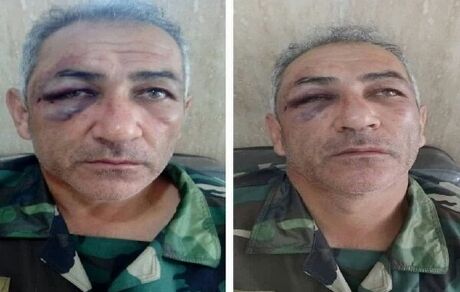 جنگل‌بان آستارایی مورد ضرب و شتم قرار گرفت