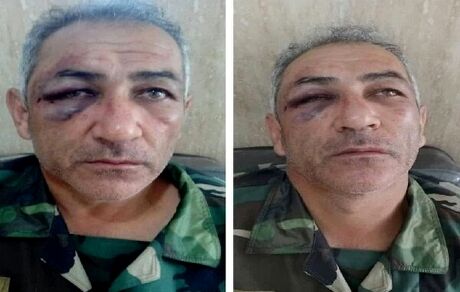 جنگل‌بان آستارایی مورد ضرب و شتم قرار گرفت