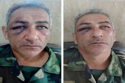 جنگل‌بان آستارایی مورد ضرب و شتم قرار گرفت