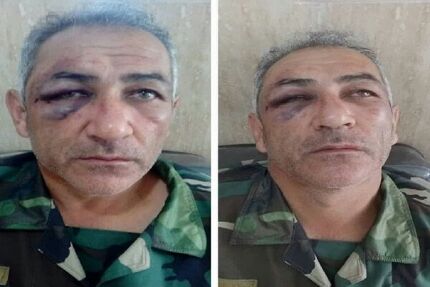 جنگل‌بان آستارایی مورد ضرب و شتم قرار گرفت