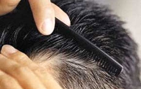 
عوامل سفیدی زودرس موها
