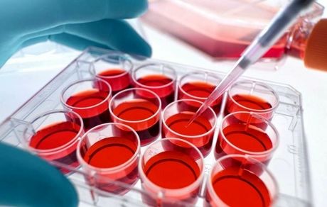  هزینه ذخیره‌ سازی خون بند ناف