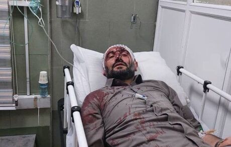 حمله مسلحانه به شهردار ناحیه ۳ منطقه ۱۹ تهران / زاکانی پیگیر مجازات عاملین این حادثه