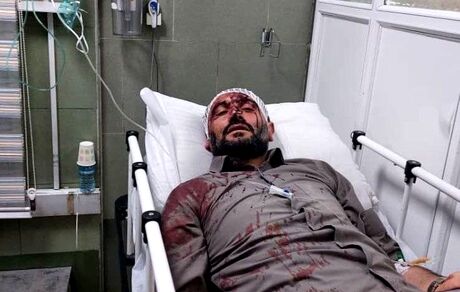 حمله مسلحانه به شهردار ناحیه ۳ منطقه ۱۹ تهران / زاکانی پیگیر مجازات عاملین این حادثه