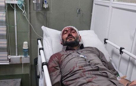حمله مسلحانه به شهردار ناحیه ۳ منطقه ۱۹ تهران / زاکانی پیگیر مجازات عاملین این حادثه