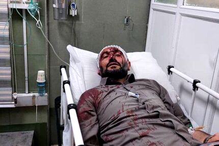 حمله مسلحانه به شهردار ناحیه ۳ منطقه ۱۹ تهران / زاکانی پیگیر مجازات عاملین این حادثه