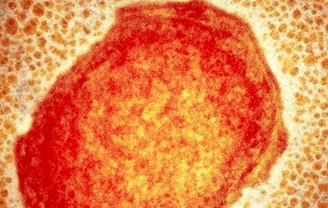 بیماری آبله میمونی در شیلی و صربستان نیز مشاهده شد
