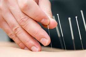 طب سوزنی و یائسگی