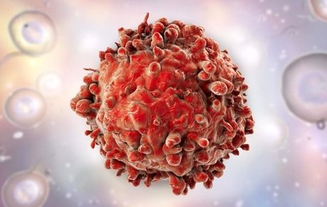 سرطان مغز استخوان؛ پیشگیری، علایم و درمان/خطر کرونا برای مبتلایان این بیماری