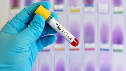 ویروس زیکا در آستانه تبدیل شدن به جدیدترین همه گیری