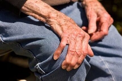 نیمی از افراد بالای ۵۰ سال کشور به پوکی استخوان دچار هستند