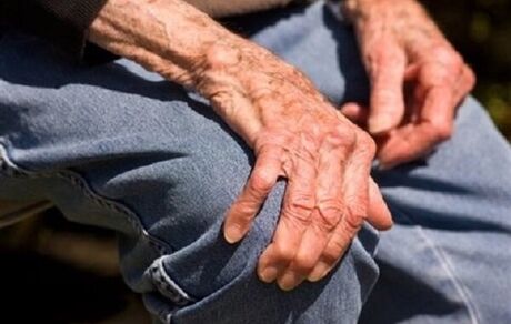نیمی از افراد بالای ۵۰ سال کشور به پوکی استخوان دچار هستند