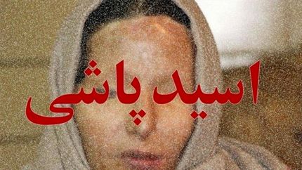 دستگیری عامل اسیدپاشی اشتباهی به همسر در تهران