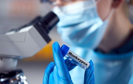 ویروس آبله میمونی روی سطوح باقی می ماند