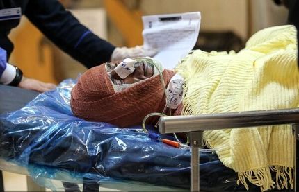 آمار مصدومان چهارشنبه سوری به بیش از ۱۷۰۰ تن رسید/ ۱۰۰ نفر دچار قطع عضو و ۱۷ نفر فوتی