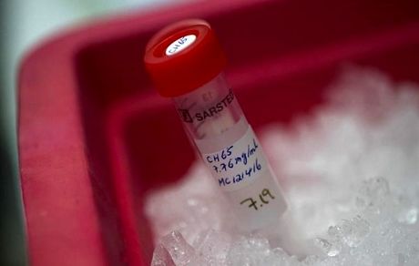 کشف علت جدید برای فوت بیماران مبتلا به کرونا