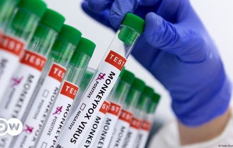 شیوع یک بیماری ویروسی دیگر در چین