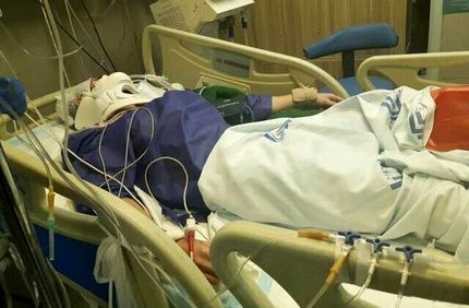جمجمه یک بیمار در بیمارستان شهر میناب گم شد