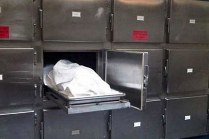 رسوایی باورنکردنی در بزرگترین بیمارستان اسکاتلند