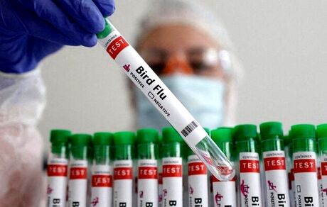 تاکنون مورد انسانی آنفلوانزای پرندگان H5N1 در کشورمان گزارش نشده است