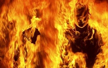 مرگ یک دختر بر اثر سوختگی در کردستان تایید شد