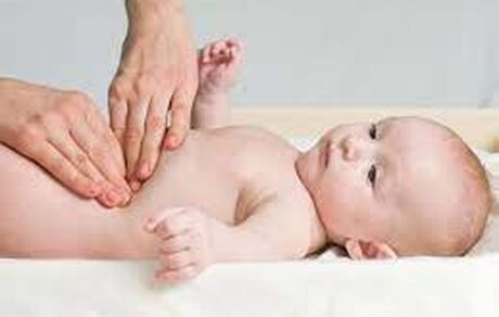شایع‌ترین فتق در دوران کودکی