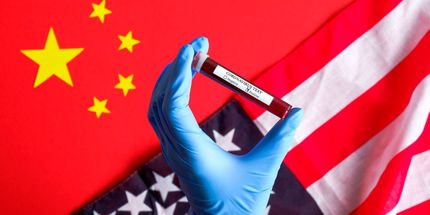 کدام کشور بیشترین سود را از کرونا برد؟