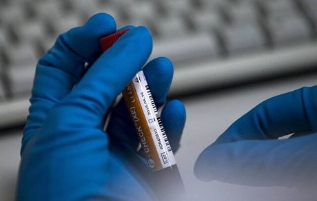 ۸ دوپینگی دیگر در ورزش ایران