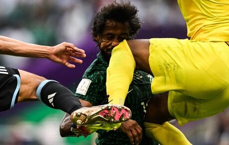 بازیکن مصدوم عربستان در جام جهانی ۲۰۲۲ جراحی شد