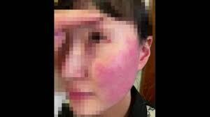 برکناری سفیر بلژیک بدلیل حمله همسرش به یک شهروند کره‌ای در کره جنوبی