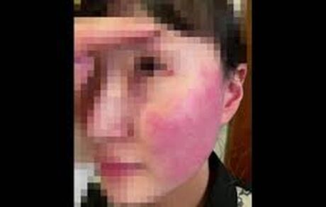 برکناری سفیر بلژیک بدلیل حمله همسرش به یک شهروند کره‌ای در کره جنوبی
