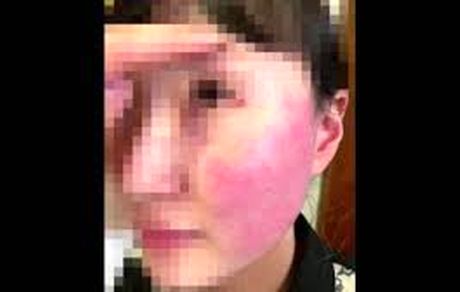 برکناری سفیر بلژیک بدلیل حمله همسرش به یک شهروند کره‌ای در کره جنوبی