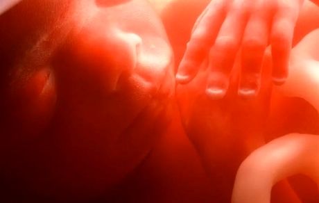  دیه "جنین سقط‌شده صاحب روح" ۴۸۰میلیون تومان!+ جزئیات