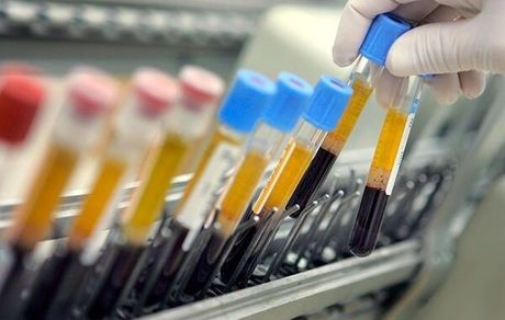 محکومیت ۲۱ ورزشکار ایرانی بدلیل دوپینگ در سال گذشته