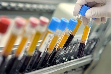 محکومیت ۲۱ ورزشکار ایرانی بدلیل دوپینگ در سال گذشته