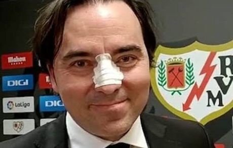 مدیر برنامه یک فوتبالیست، بینی رئیس باشگاه را شکست