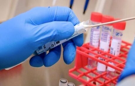 ۱۰۰ ورودی کشور به آزمایش سریع کرونا مجهزشد