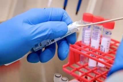 ۱۰۰ ورودی کشور به آزمایش سریع کرونا مجهزشد