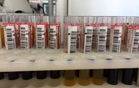 افزایش آمار اعمال جراحی‌ و درخواست خون/ذخایر خون استان تهران در شرایط شکننده‌